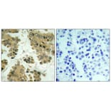 Immunohistochemistry - Akt2 (Ab-474) Antibody from Signalway Antibody (21155) - Antibodies.com