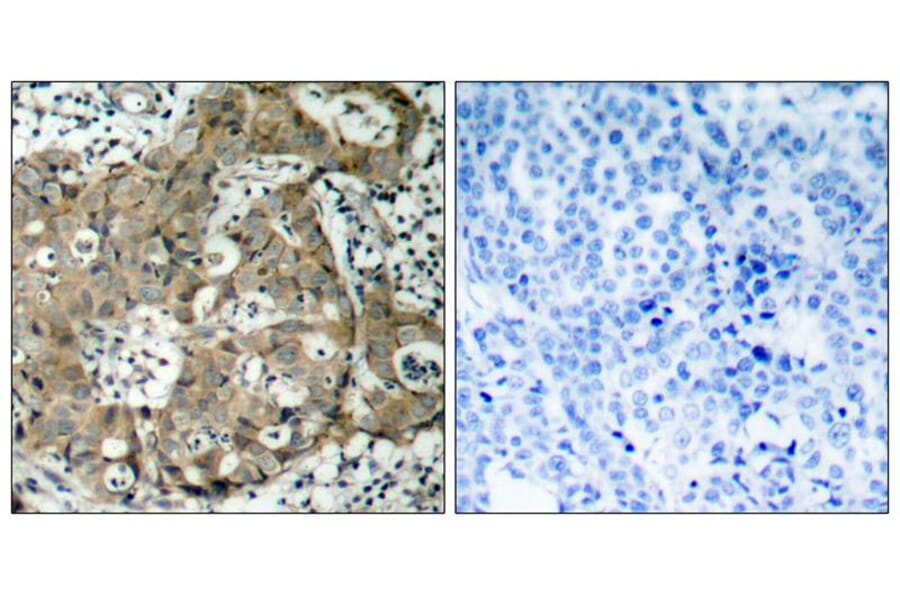 Immunohistochemistry - FKHR (Ab-319) Antibody from Signalway Antibody (21161) - Antibodies.com