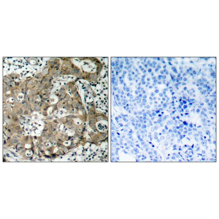Immunohistochemistry - FKHR (Ab-319) Antibody from Signalway Antibody (21161) - Antibodies.com