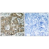 Immunohistochemistry - FKHR (Ab-319) Antibody from Signalway Antibody (21161) - Antibodies.com