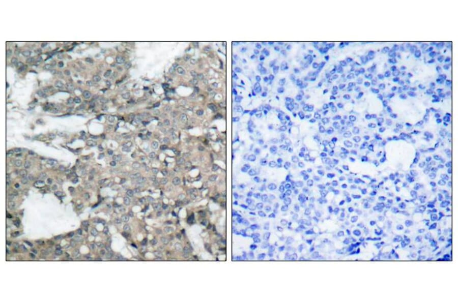 Immunohistochemistry - MEK1 (Ab-221) Antibody from Signalway Antibody (21175) - Antibodies.com