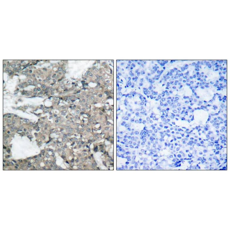 Immunohistochemistry - MEK1 (Ab-221) Antibody from Signalway Antibody (21175) - Antibodies.com
