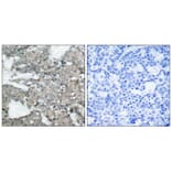 Immunohistochemistry - MEK1 (Ab-221) Antibody from Signalway Antibody (21175) - Antibodies.com