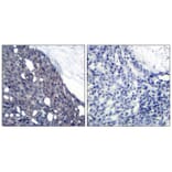 Immunohistochemistry - IkB-a (Ab-42) Antibody from Signalway Antibody (21176) - Antibodies.com