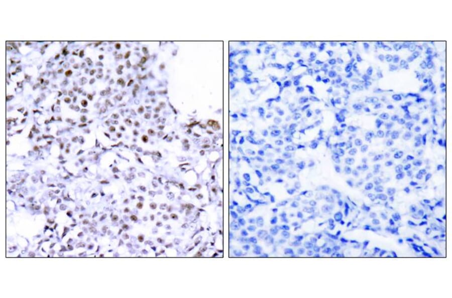 Immunohistochemistry - SMC1 (Ab-957) Antibody from Signalway Antibody (21190) - Antibodies.com