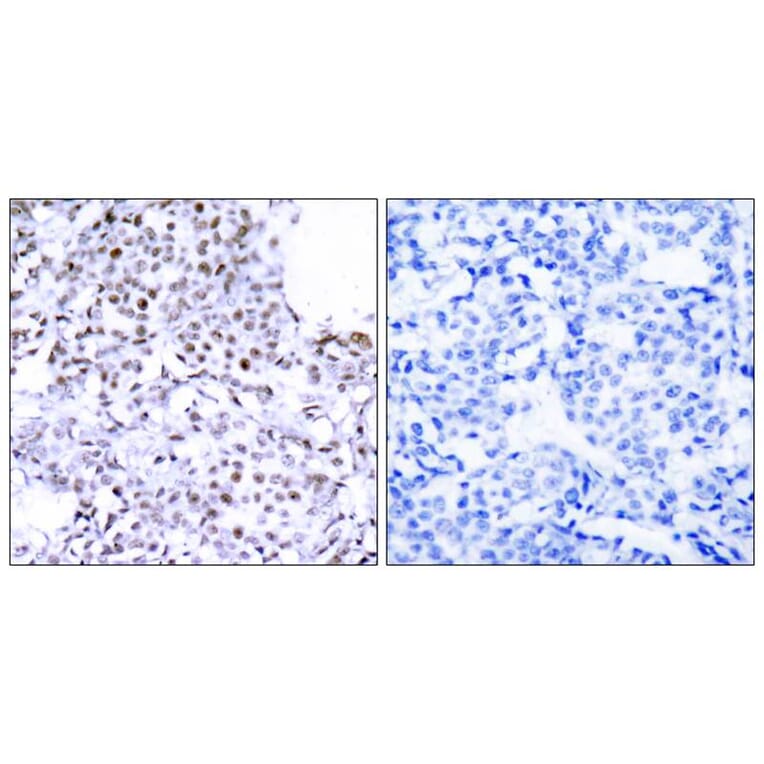 Immunohistochemistry - SMC1 (Ab-957) Antibody from Signalway Antibody (21190) - Antibodies.com