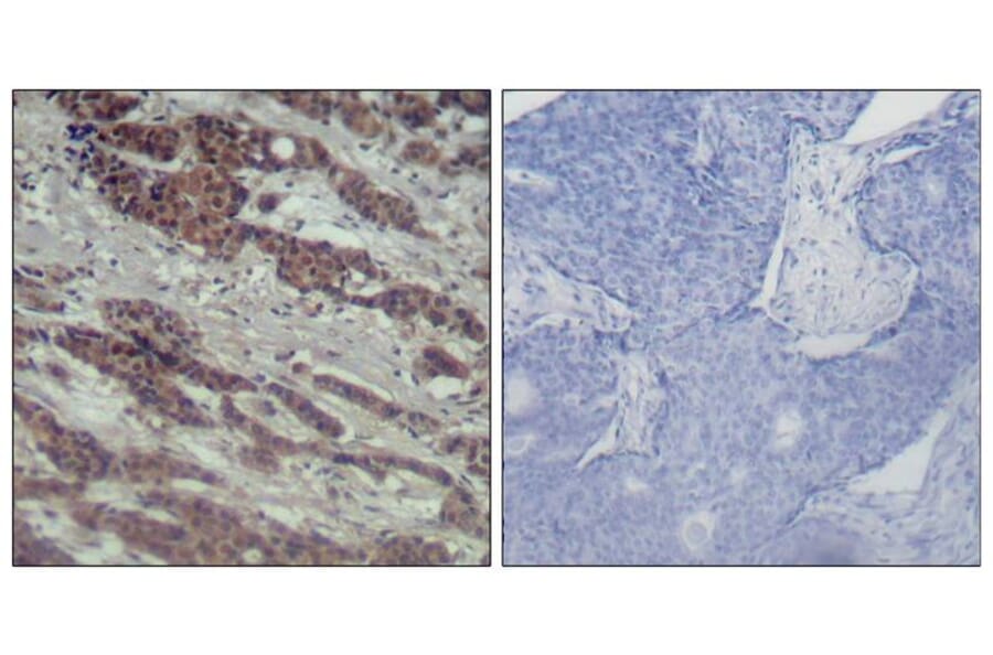 Immunohistochemistry - Raf1 (Ab-338) Antibody from Signalway Antibody (21202) - Antibodies.com