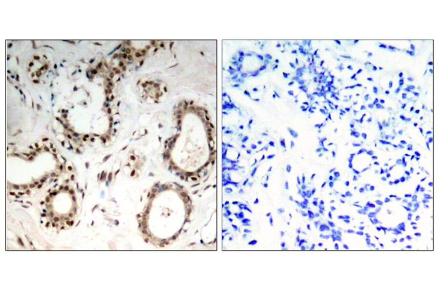 Immunohistochemistry - HSF1 (Ab-307) Antibody from Signalway Antibody (21206) - Antibodies.com
