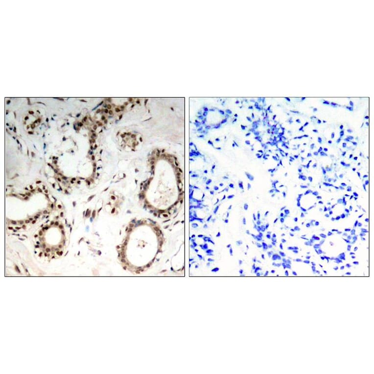 Immunohistochemistry - HSF1 (Ab-307) Antibody from Signalway Antibody (21206) - Antibodies.com