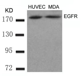 Western blot - EGFR (Ab-869) Antibody from Signalway Antibody (21222) - Antibodies.com