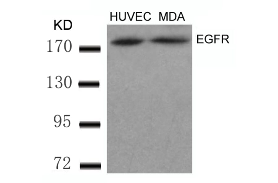 Western blot - EGFR (Ab-869) Antibody from Signalway Antibody (21222) - Antibodies.com