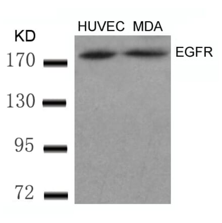 Western blot - EGFR (Ab-869) Antibody from Signalway Antibody (21222) - Antibodies.com