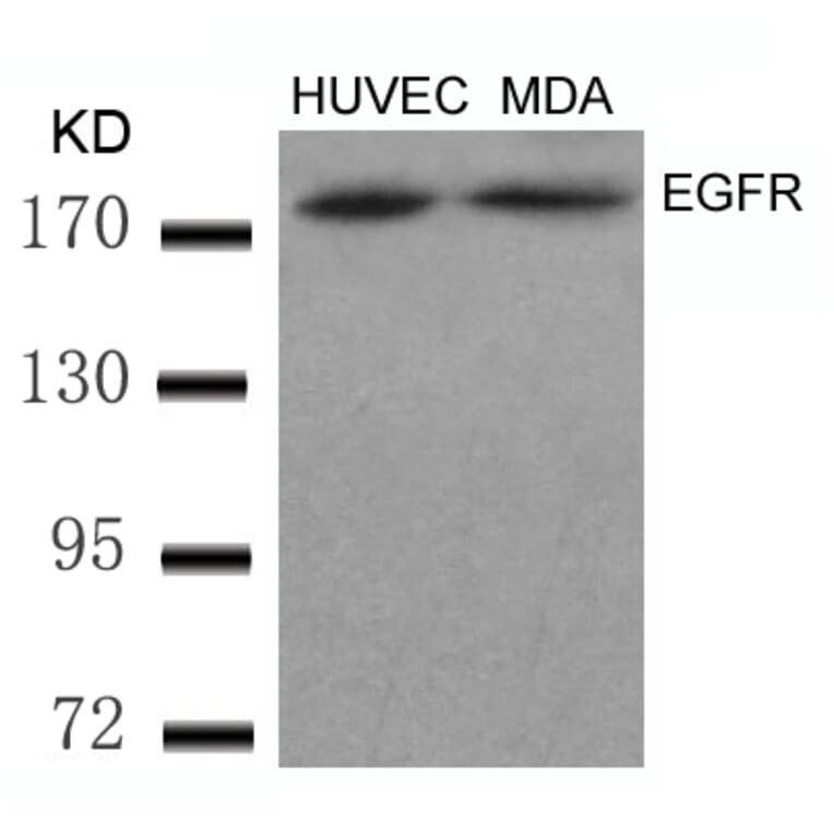 Western blot - EGFR (Ab-869) Antibody from Signalway Antibody (21222) - Antibodies.com