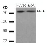 Western blot - EGFR (Ab-869) Antibody from Signalway Antibody (21222) - Antibodies.com