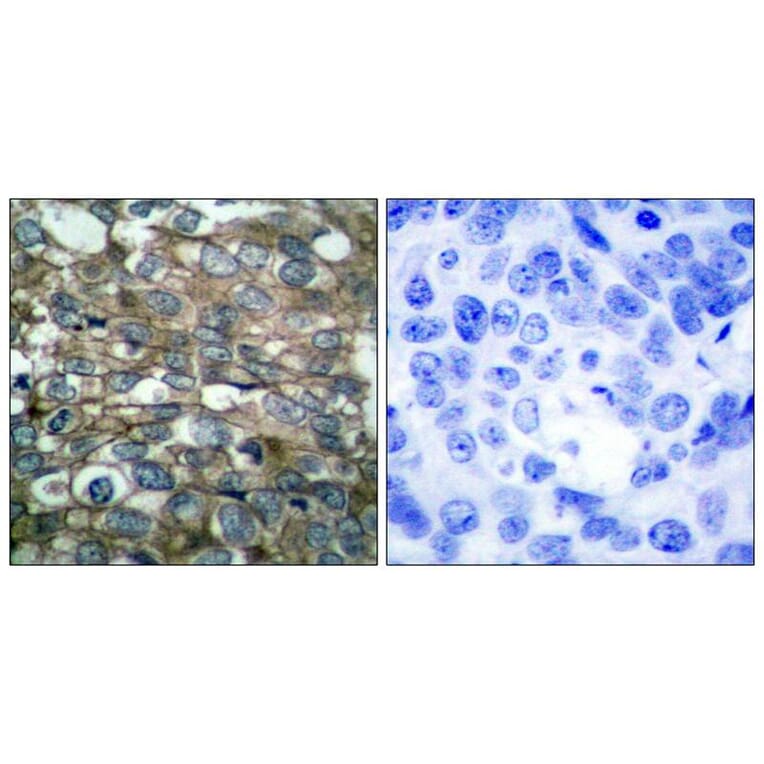 Immunohistochemistry - EGFR (Ab-869) Antibody from Signalway Antibody (21222) - Antibodies.com