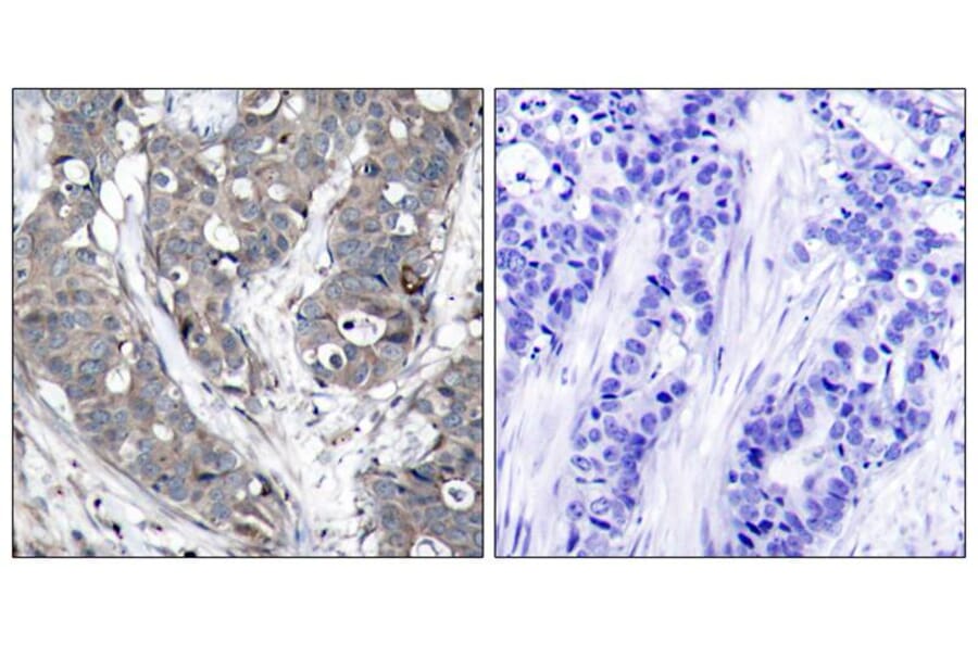 Immunohistochemistry - HSP27 (Ab-78) Antibody from Signalway Antibody (21239) - Antibodies.com