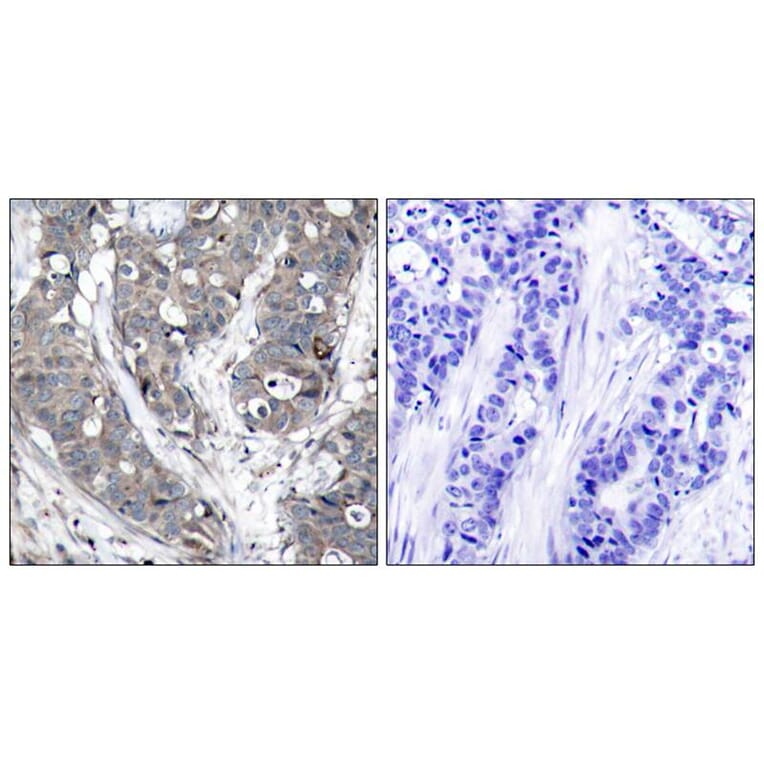 Immunohistochemistry - HSP27 (Ab-78) Antibody from Signalway Antibody (21239) - Antibodies.com
