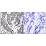 Immunohistochemistry - HSP27 (Ab-78) Antibody from Signalway Antibody (21239) - Antibodies.com