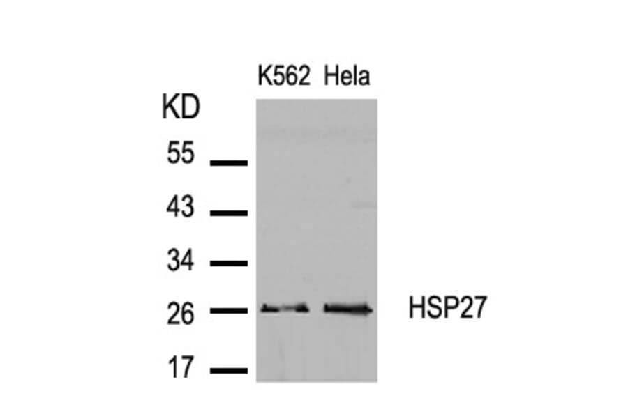 Western blot - HSP27 (Ab-82) Antibody from Signalway Antibody (21240) - Antibodies.com