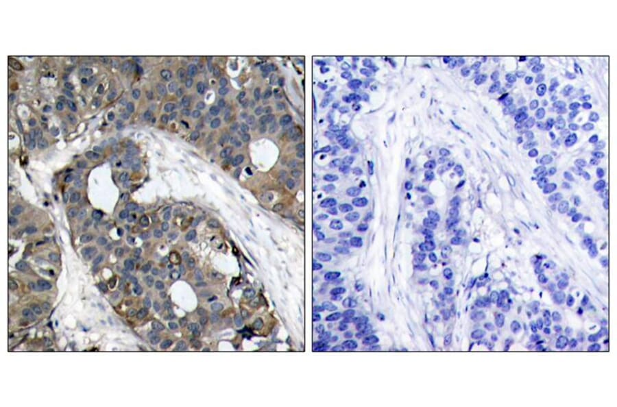Immunohistochemistry - HSP27 (Ab-82) Antibody from Signalway Antibody (21240) - Antibodies.com