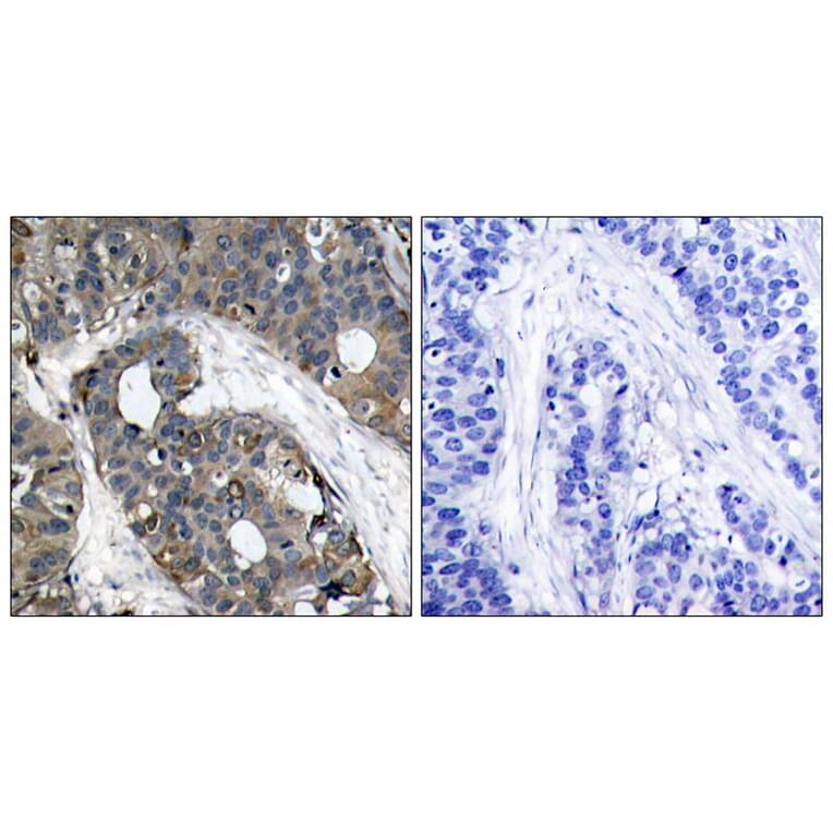 Immunohistochemistry - HSP27 (Ab-82) Antibody from Signalway Antibody (21240) - Antibodies.com