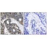 Immunohistochemistry - HSP27 (Ab-82) Antibody from Signalway Antibody (21240) - Antibodies.com