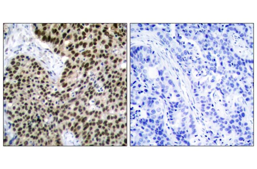 Immunohistochemistry - HSF1 (Ab-303) Antibody from Signalway Antibody (21255) - Antibodies.com