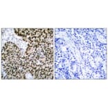 Immunohistochemistry - HSF1 (Ab-303) Antibody from Signalway Antibody (21255) - Antibodies.com