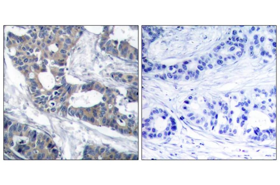 Immunohistochemistry - MEK1 (Ab-291) Antibody from Signalway Antibody (21286) - Antibodies.com