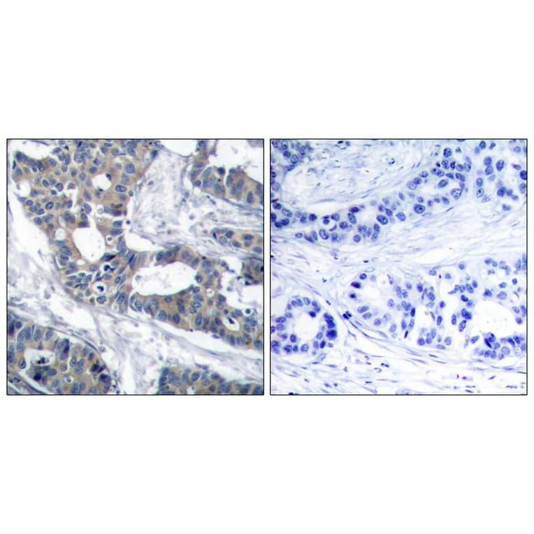 Immunohistochemistry - MEK1 (Ab-291) Antibody from Signalway Antibody (21286) - Antibodies.com