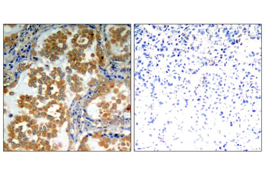 Immunohistochemistry - PKCz (Ab-410) Antibody from Signalway Antibody (21314) - Antibodies.com