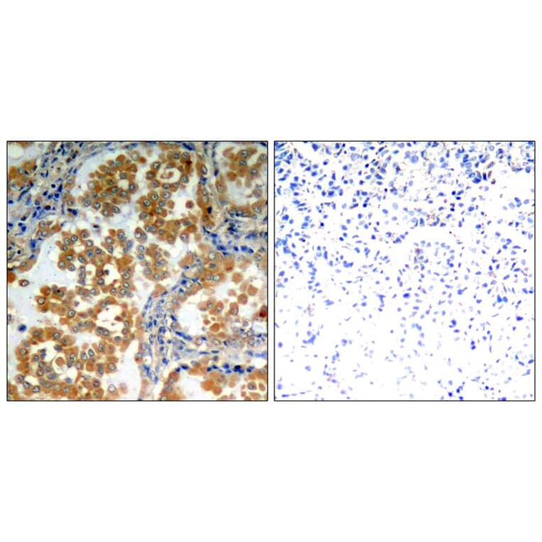 Immunohistochemistry - PKCz (Ab-410) Antibody from Signalway Antibody (21314) - Antibodies.com