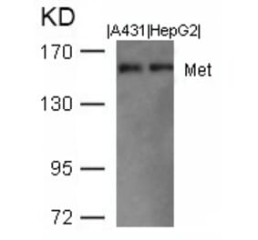 Western blot - Met (Ab-1003) Antibody from Signalway Antibody (21548) - Antibodies.com