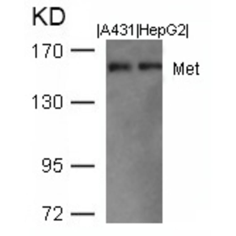 Western blot - Met (Ab-1003) Antibody from Signalway Antibody (21548) - Antibodies.com