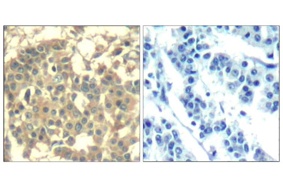 Immunohistochemistry - Met (Ab-1003) Antibody from Signalway Antibody (21548) - Antibodies.com