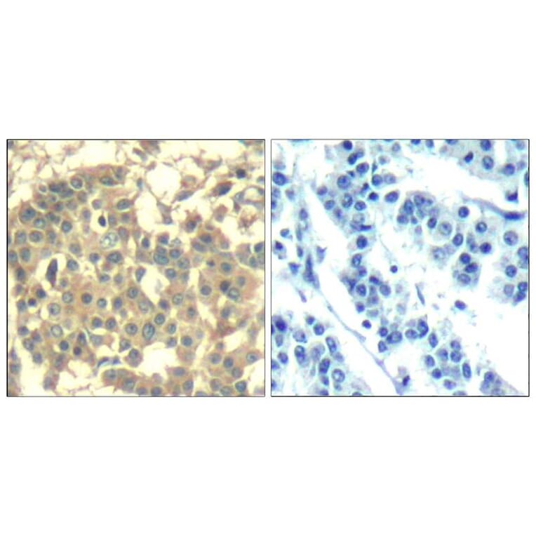 Immunohistochemistry - Met (Ab-1003) Antibody from Signalway Antibody (21548) - Antibodies.com