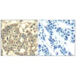 Immunohistochemistry - Met (Ab-1003) Antibody from Signalway Antibody (21548) - Antibodies.com