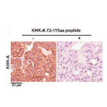 Immunohistochemistry - KHK Isoform A Antibody from Signalway Antibody (21708) - Antibodies.com