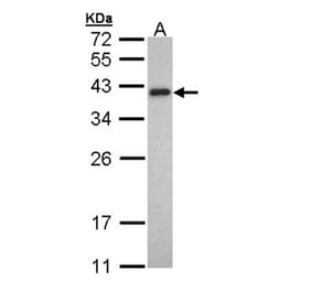 Tropomyosin 2 antibody from Signalway Antibody (22134) - Antibodies.com