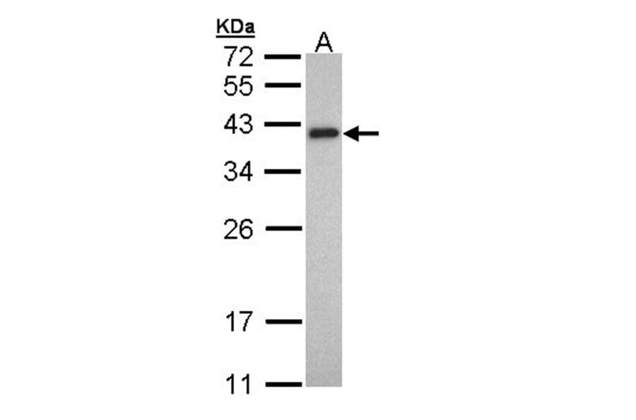 Tropomyosin 2 antibody from Signalway Antibody (22134) - Antibodies.com