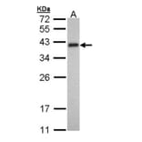 Tropomyosin 2 antibody from Signalway Antibody (22134) - Antibodies.com