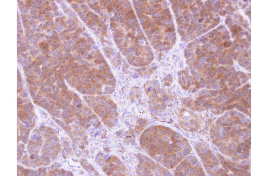 Immunohistochemistry - Tropomyosin 2 antibody from Signalway Antibody (22134) - Antibodies.com