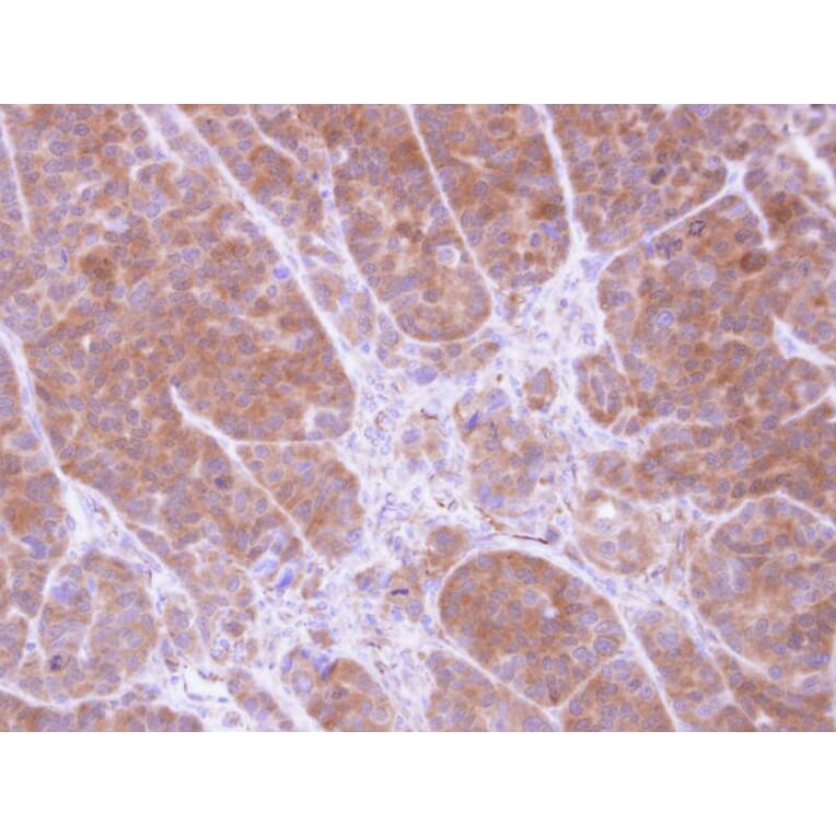 Immunohistochemistry - Tropomyosin 2 antibody from Signalway Antibody (22134) - Antibodies.com