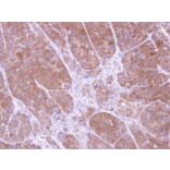 Immunohistochemistry - Tropomyosin 2 antibody from Signalway Antibody (22134) - Antibodies.com