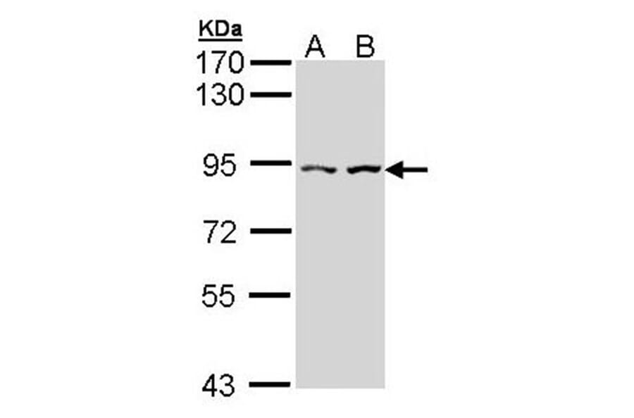 Alpha-catulin antibody from Signalway Antibody (22278) - Antibodies.com