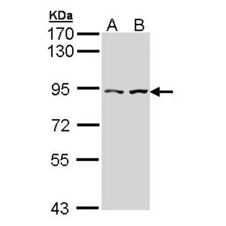 Alpha-catulin antibody from Signalway Antibody (22278) - Antibodies.com