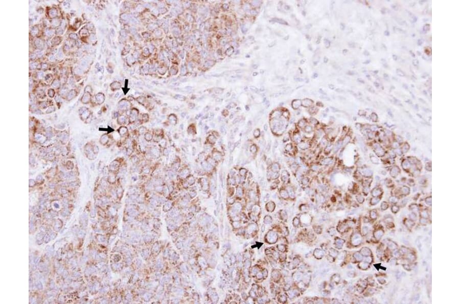 Immunohistochemistry - Alpha-catulin antibody from Signalway Antibody (22278) - Antibodies.com