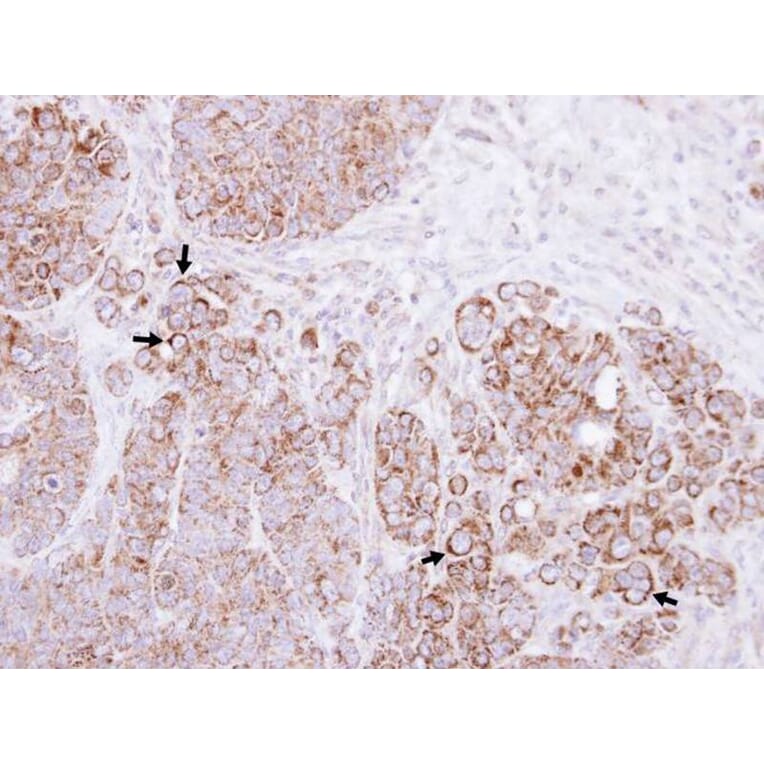 Immunohistochemistry - Alpha-catulin antibody from Signalway Antibody (22278) - Antibodies.com