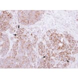 Immunohistochemistry - Alpha-catulin antibody from Signalway Antibody (22278) - Antibodies.com