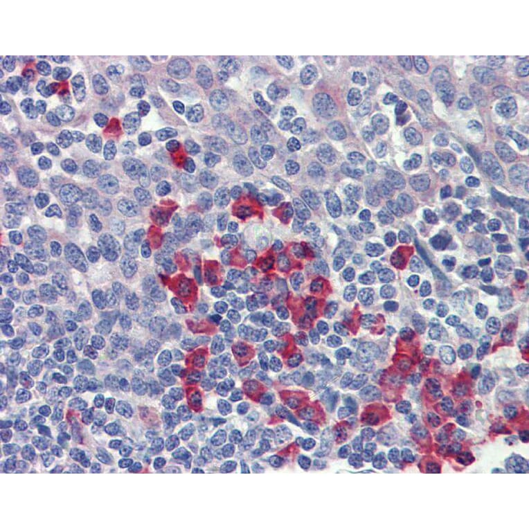 Immunohistochemistry - beta-Amyloid antibody from Signalway Antibody (22965) - Antibodies.com